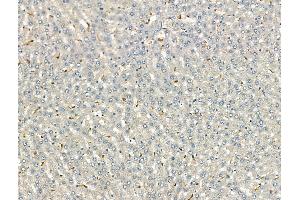 ABIN7093170 and ABIN7098475 at 1/100 staining Rat liver tissue by IHC-P. (C3 anticorps)