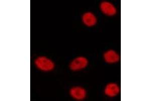 ABIN6275329 staining HepG2 by IF/ICC. (NOLC1 anticorps  (C-Term))