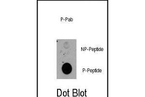 Dot blot analysis of anti-RPS6KA1-p Pab (R) on nitrocellulose membrane.