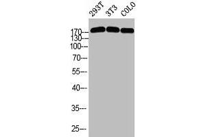 Western blot analysis of 293T 3T3 COLO using p-Topo IIα (S1525) antibody. (Topoisomerase II alpha anticorps  (pSer1525))