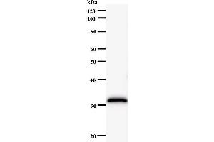 Western Blotting (WB) image for anti-F-Box and Leucine-Rich Repeat Protein 4 (FBXL4) antibody (ABIN931099)