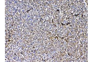 IHC analysis of MBL2 using anti-MBL2 antibody .