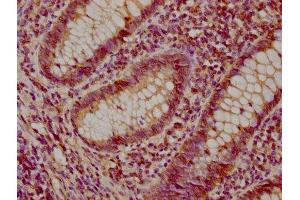 IHC image of ABIN7170949 diluted at 1:200 and staining in paraffin-embedded human appendix tissue performed on a Leica BondTM system.