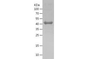 Western Blotting (WB) image for MutL Homolog 1 (MLH1) (AA 407-756) protein (His tag) (ABIN7124036) (MLH1 Protein (AA 407-756) (His tag))