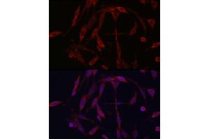 Immunofluorescence analysis of PC-12 cells using KIF5A Rabbit pAb (ABIN1680589, ABIN3017664, ABIN3017665 and ABIN6220202) at dilution of 1:250 (40x lens).