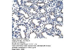Rabbit Anti-POP4 Antibody  Paraffin Embedded Tissue: Human Lung Cellular Data: Alveolar cells Antibody Concentration: 4. (RPP29 anticorps  (C-Term))