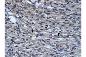 CLIC5 antibody was used for immunohistochemistry at a concentration of 4-8 ug/ml to stain Myocardial cells (arrows) in Human Heart. (CLIC5 anticorps  (C-Term))