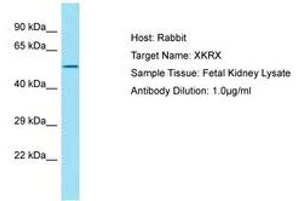 XKRX 抗体  (AA 87-136)