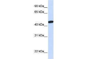 WB Suggested Anti-KRR1 Antibody Titration:  0. (KRR1 anticorps  (C-Term))