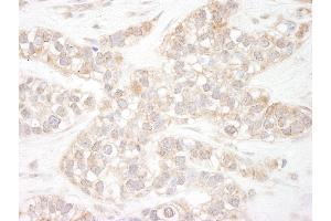 Immunohistochemistry (IHC) image for anti-Flightless I Homolog (FLII) (AA 425-475) antibody (ABIN7453708)