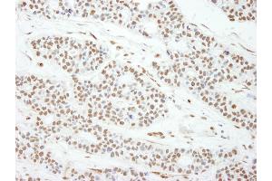 anti-MAD2 (AA 100-150) antibody