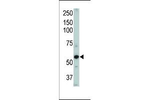 Western blot of ACVRL1 Pab (ABIN392241 and ABIN2841932).
