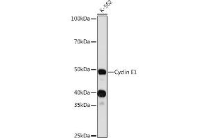 Western blot analysis of extracts of K-562 cells, using Cyclin E1 antibody (ABIN7266564) at 1:1000 dilution.