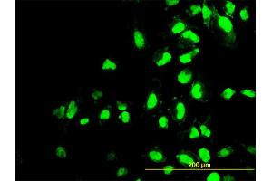 Immunofluorescence of monoclonal antibody to POLR1C on HeLa cell. (POLR1C anticorps  (AA 1-346))