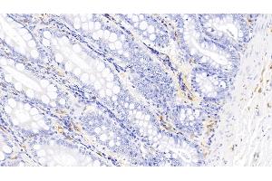 Detection of IL17 in Canine Colon Tissue using Polyclonal Antibody to Interleukin 17 (IL17)