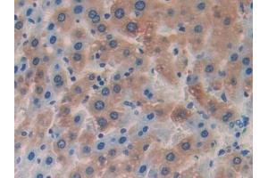 Detection of IL18BP in Rat Liver Tissue using Polyclonal Antibody to Interleukin 18 Binding Protein (IL18BP)