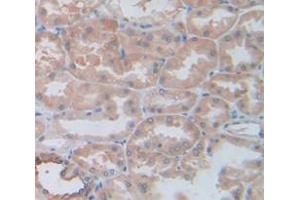 IHC-P analysis of Human Tissue, with DAB staining. (L1CAM anticorps  (AA 526-690))