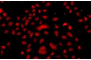 Immunofluorescence analysis of A549 cells using FBXW11 Polyclonal Antibody (FBXW11 anticorps)