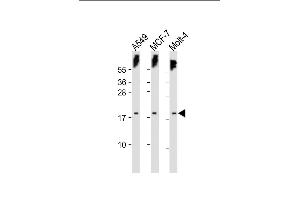 All lanes : Anti-KILLIN Antibody (C-term) at 1:500 dilution Lane 1: A549 whole cell lysate Lane 2: MCF-7 whole cell lysate Lane 3: Molt-4 whole cell lysate Lysates/proteins at 20 μg per lane. (KLLN anticorps  (C-Term))