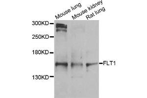 Western blot analysis of extracts of various cells, using FLT1 antibody. (FLT1 anticorps)