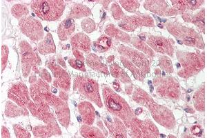 Rabbit Anti-RPE antibody Catalog Number: ARP56726 Formalin Fixed Paraffin Embedded Tissue: Human Adult Heart  Observed Staining: Cytoplasm in hepatocytes Primary Antibody Concentration: 1:600 Secondary Antibody: Donkey anti-Rabbit-Cy3 Secondary Antibody Concentration: 1:200 Magnification: 20X Exposure Time: 0.