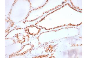 Formalin-fixed, paraffin-embedded human Thyroid stained with TTF-1 Rabbit Recombinant Monoclonal Antibody (NX2.