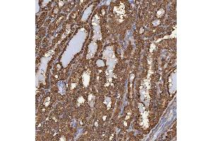 IHC analysis of SBP/SELENBP1 using anti-SBP/SELENBP1 antibody (ABIN7600755). (SELENBP1 anticorps  (AA 23-462))