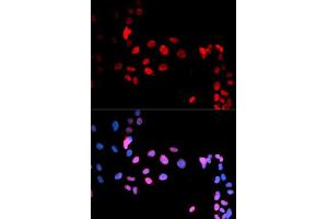 Immunofluorescent staining of U-2 OS cells with MAX (phospho S11) polyclonal antibody  at 1:50-1:200 dilution. (MAX anticorps  (pSer11))