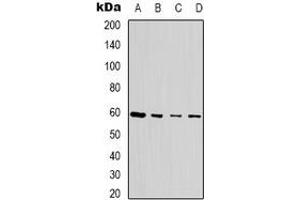 Western blot analysis of SEN54 expression in MCF7 (A), Jurkat (B), HEK293T (C), NIH3T3 (D) whole cell lysates. (TSEN54 anticorps)