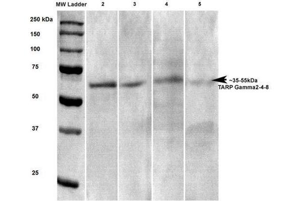 Stargazin anticorps  (AA 203-323)
