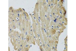 Immunohistochemistry of paraffin-embedded Rat heart using CKMT2 Polyclonal Antibody at dilution of 1:100 (40x lens). (CKMT2 anticorps)