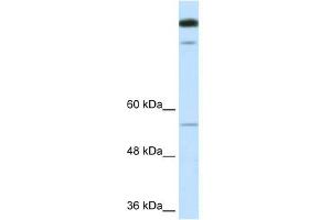 WB Suggested Anti-TIMELESS Antibody Titration:  0. (TIMELESS anticorps  (N-Term))