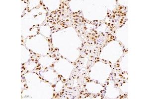 Immunohistochemistry of paraffin embedded mouse lung using WDR13 (ABIN7076212) at dilution of 1: 2500 (400x lens)