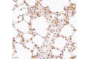 Immunohistochemistry of paraffin embedded mouse lung using WDR13 (ABIN7076212) at dilution of 1: 2500 (400x lens) (WDR13 anticorps)