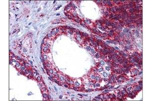 Human Prostate: Formalin-Fixed, Paraffin-Embedded (FFPE)