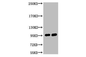 Western blot analysis of 1) Hela, 2) 293T, diluted at 1:2000. (ABCB5 anticorps)