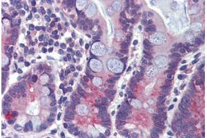 Human Small Intestine (formalin-fixed, paraffin-embedded) stained with ABCA5 antibody ABIN462240 followed by biotinylated goat anti-rabbit IgG secondary antibody ABIN481713, alkaline phosphatase-streptavidin and chromogen.