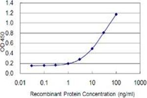 Detection limit for recombinant GST tagged ZNF100 is 0. (ZNF100 anticorps  (AA 99-206))