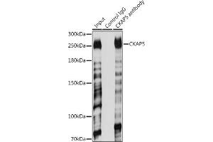 Immunoprecipitation analysis of 200 μg extracts of Jurkat cells using 3 μg CK antibody (ABIN6127628, ABIN6138647, ABIN6138648 and ABIN6224627). (CKAP5 anticorps  (AA 1763-2032))