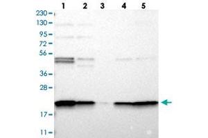 Western blot analysis of Lane 1: RT-4, Lane 2: U-251 MG, Lane 3: Human Plasma, Lane 4: Liver, Lane 5: Tonsil with TMEM109 polyclonal antibody  at 1:250-1:500 dilution. (TMEM109 anticorps)