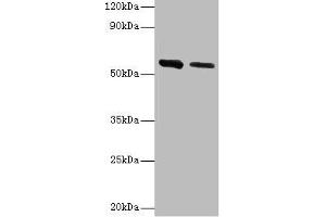 Western blot All lanes: ADSL antibody at 2 μg/mL Lane 1: Hela whole cell lysate Lane 2: Mouse heart tissue Secondary Goat polyclonal to rabbit IgG at 1/10000 dilution Predicted band size: 55, 49 kDa Observed band size: 55 kDa (Adenylosuccinate Lyase anticorps  (AA 1-310))
