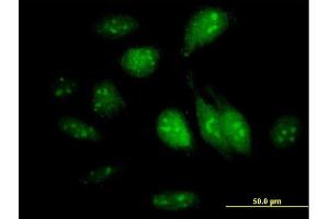 Immunofluorescence of purified MaxPab antibody to GTPBP4 on HeLa cell. (GTPBP4 anticorps  (AA 1-634))