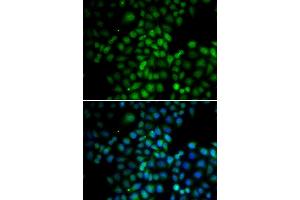 Immunofluorescence analysis of HeLa cells using C11orf30 antibody (ABIN6127845, ABIN6137722, ABIN6137724 and ABIN6217721). (EMSY anticorps  (AA 1153-1322))