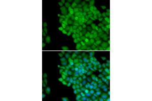 Immunofluorescence analysis of HeLa cells using MAGE-1/MA antibody (ABIN6132325, ABIN6143435, ABIN6143436 and ABIN6221133). (MAGEA1 anticorps  (AA 1-309))