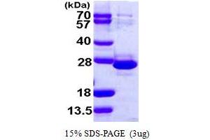 SDS-PAGE (SDS) image for Transcription Elongation Factor A (SII)-Like 1 (TCEAL1) (AA 1-159) protein (His tag) (ABIN667458)
