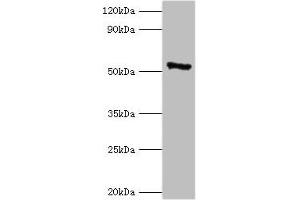 Western blot All lanes: CAMK4 antibody at 2 μg/mL + 293T whole cell lysate Secondary Goat polyclonal to rabbit IgG at 1/10000 dilution Predicted band size: 52 kDa Observed band size: 52 kDa (CAMK4 anticorps  (AA 304-473))