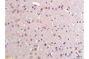 Formalin-fixed and paraffin embedded rat brain labeled with Anti-PRL Polyclonal Antibody, Unconjugated (ABIN669456) at 1:200 followed by conjugation to the secondary antibody and DAB staining. (Prolactin anticorps  (AA 165-227))