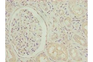 Immunohistochemistry of paraffin-embedded human kidney tissue using ABIN7143931 at dilution of 1:100 (SGCA anticorps  (AA 24-290))