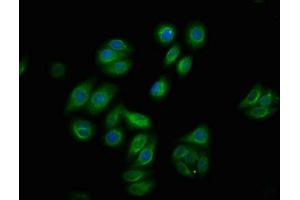 Immunofluorescence staining of HepG2 cells with ABIN7127737 at 1:100,counter-stained with DAPI. (Recombinant RAF1 anticorps  (pSer259))