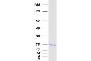 Validation with Western Blot
